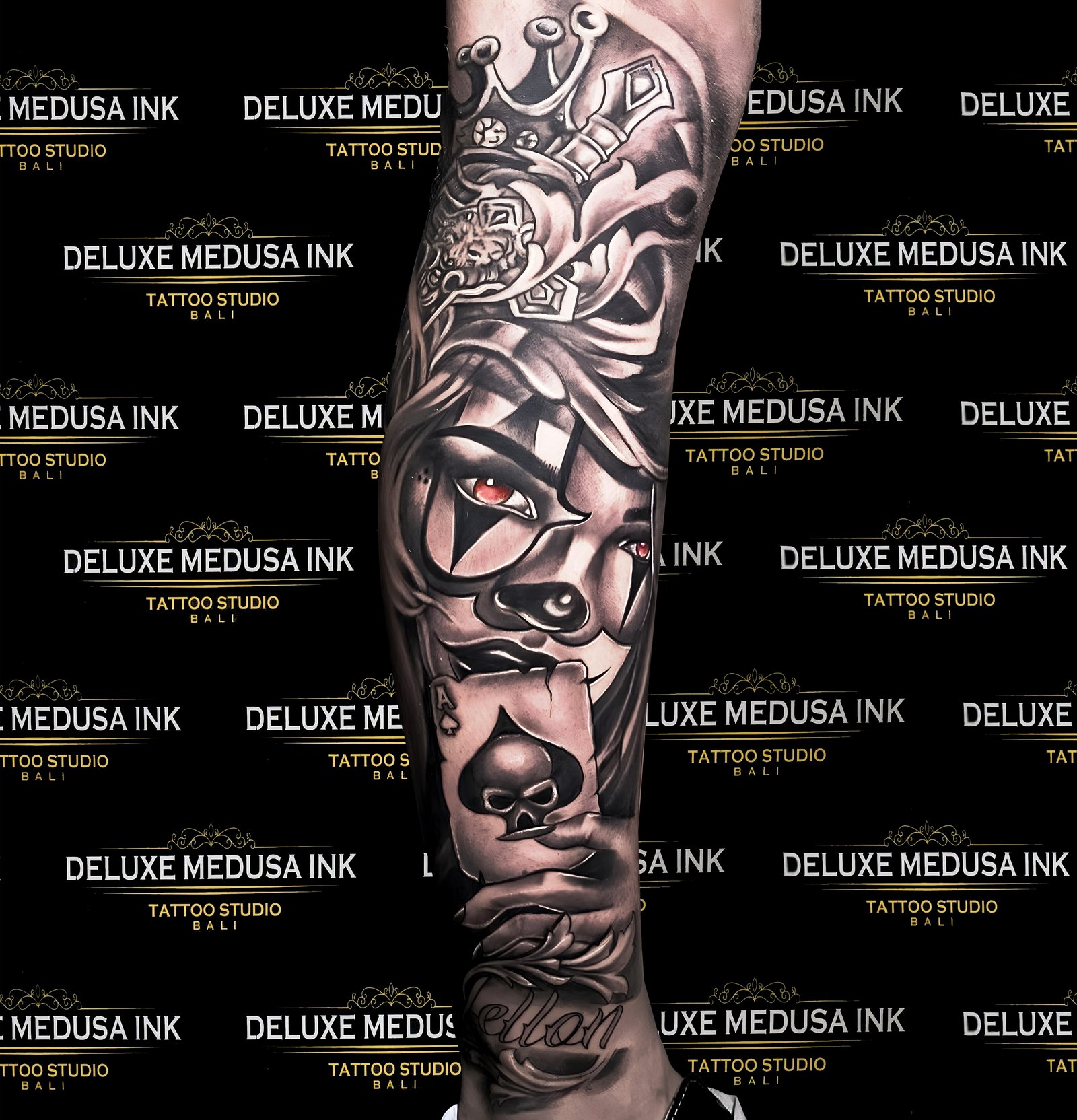 Tattoo Removal Options